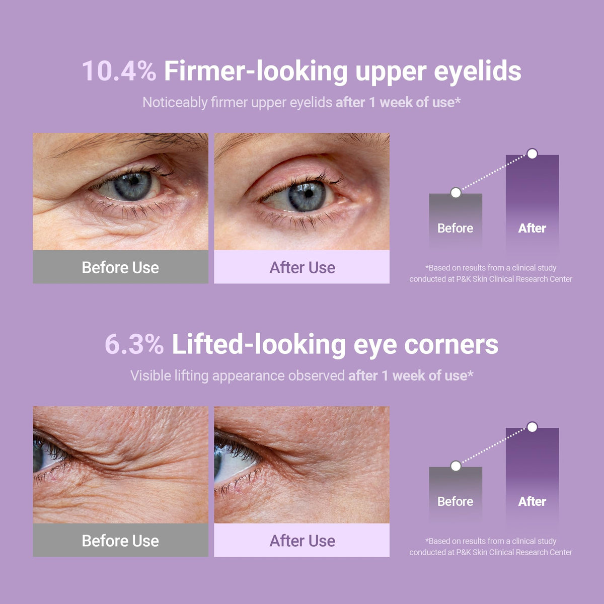 KAHI Eye Balm eyelid and eye-corner results, before and after use