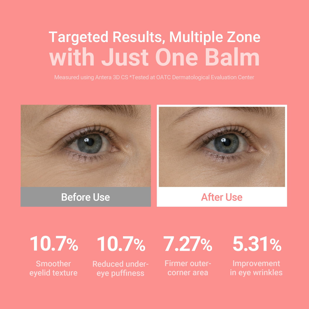 KAHI Multi Balm eye-area results, before and after use