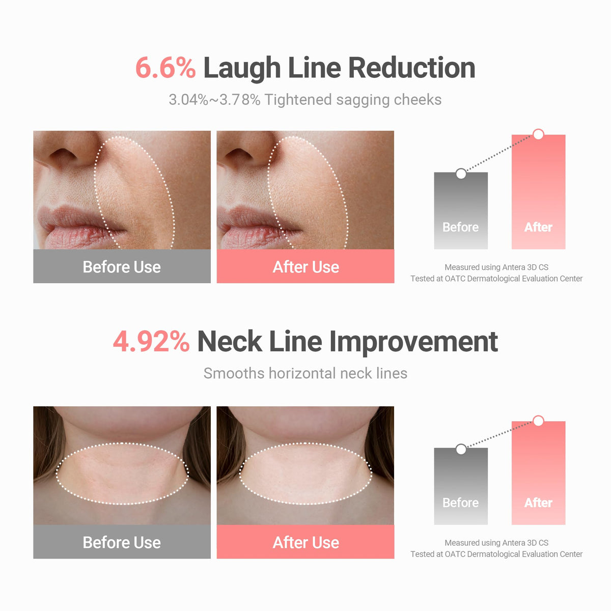 KAHI Multi Balm smile-line and neck-line results, before and after use